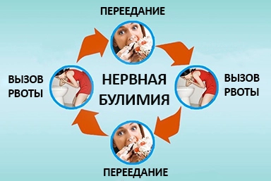 Лечение булимии в Бакале